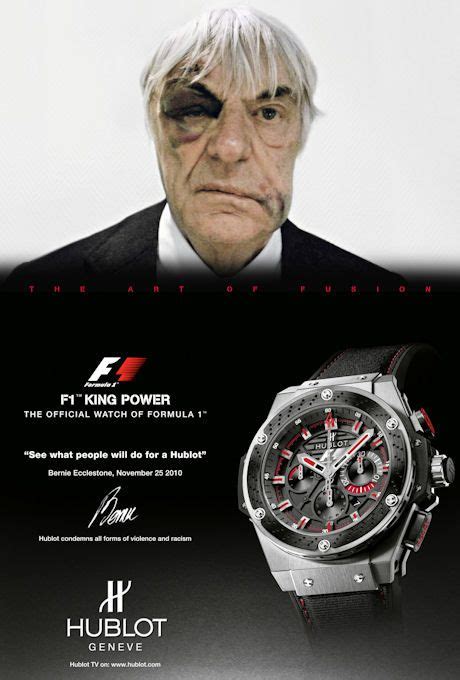 hublot black eye ad|F1 President Bernie Ecclestone Mugged in London; Hublot Stolen .